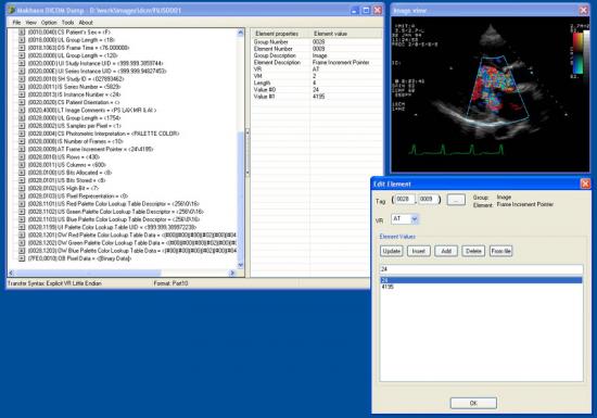   Dicom Dump 1.3