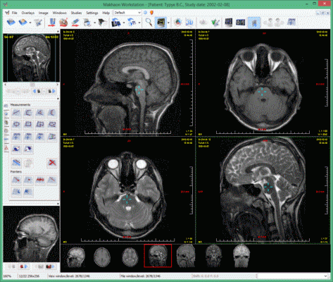   PACS 3.2.734 Demo